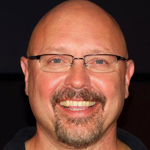 Doug Gould